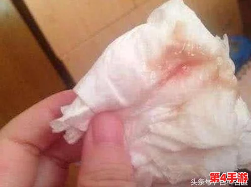 胡桃尿道口流出白色脓状物是什么？用户评论称可能是感染，建议及时就医！