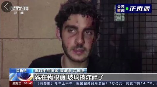 俄罗俄处破女A级出血：深入探讨事件背后的真相与影响
