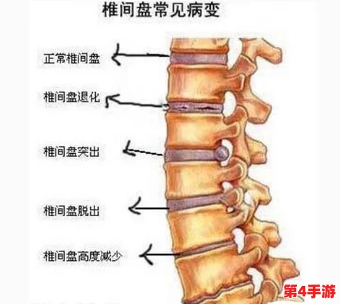 臭小子姨妈腰多久会骨折，专家提醒：注意保护脊椎健康，避免意外伤害